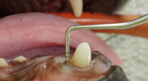 Periodontal Disease
