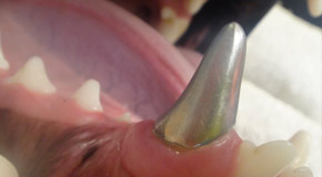 Dental Trauma